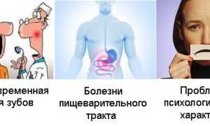 Чем грозит патология прикуса и зачем его исправлять?