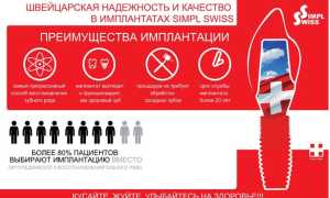 Импланты Швейцарии – лучшее на рынке стоматологических услуг