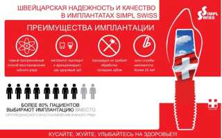 Импланты Швейцарии – лучшее на рынке стоматологических услуг
