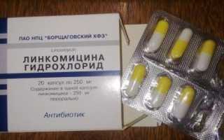 Инструкция по применению Линкомицина в стоматологии