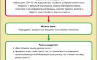 Не знаешь как вывести бородавку? Предложения докторов и народной медицины!