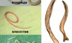 Гельминтоз у взрослых: все о неприятном явлении