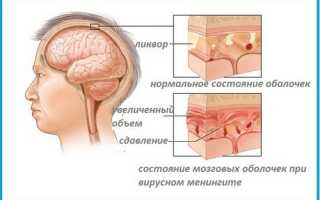 Возможные осложнения после гайморита