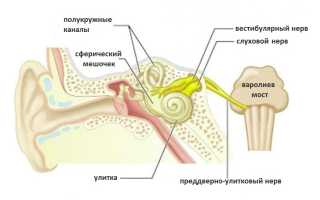 Что нужно знать о кохлеарном неврите?