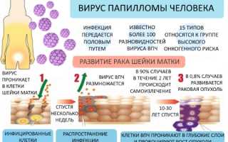 Папиллома на веке глаза: как удалить, как лечить, причины возникновения