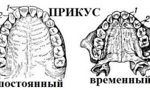 Особенности, формирование и способы исправления нарушений постоянного прикуса