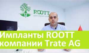 15 важных особенностей имплантов roott