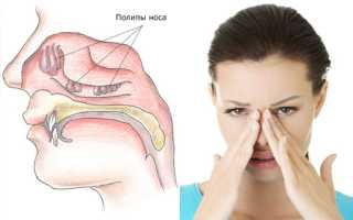 Чем лечить герпес в носу, его причины и симптомы
