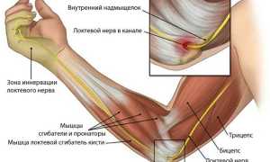 Симптомы, диагностика и лечение неврита локтевого нерва
