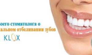 6 причин использования метода Klox для отбеливания зубов