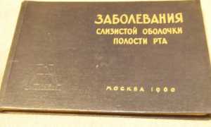 Всевозможные патологии слизистой оболочки полости рта