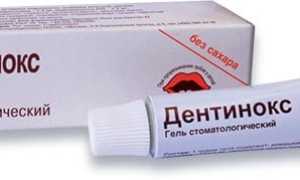 Инструкция по применению Дентинокс геля