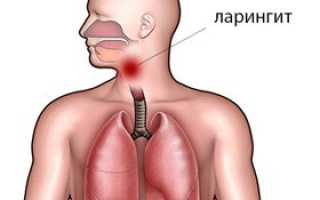 Лечение вирусного ларингита у детей и взрослых