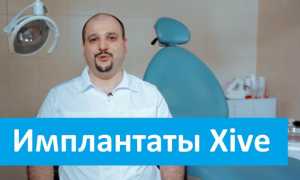 Xive — импланты для богатых и достойный выбор для разумных
