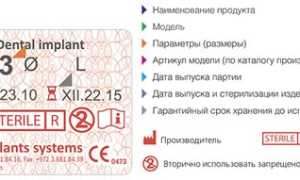 Качество имплантации зубов с имплантами Implay