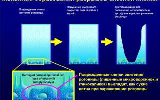 Офтагель (глазные капли): инструкция по применению, цена, отзывы, аналоги