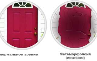 Виды, симптомы и лечение метаморфопсии