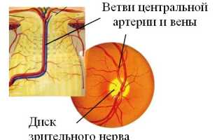 Атрофия зрительного нерва: МКБ-10, симптомы, причины, как лечить