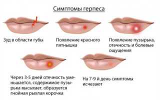 Вирус герпеса — виды, причины и симптомы появления