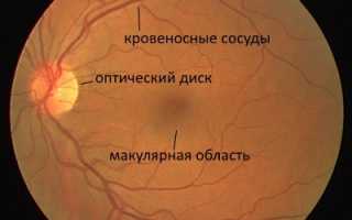 Сетчатка глаза: строение и функции, основные патологии