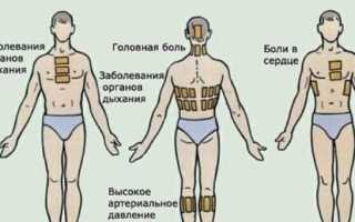 Компресс на горло при ларингите, техника изготовления и наложения