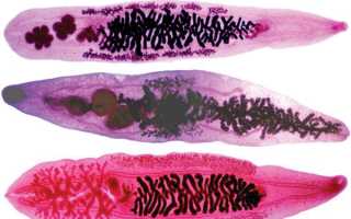 Как лечить описторхоз при беременности?