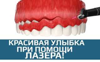Виды гингивэктомии для спасения десен